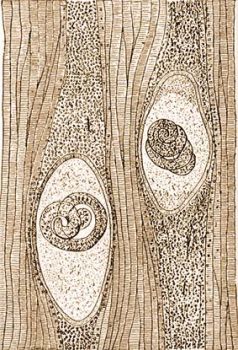 2. Betokolt Trichinella-�lc�k sert�s izomzat�ban. (Kofl�n rajza.)
