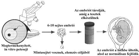 be�ltet�s el�tti diagn�zis, in vitro megterm�keny�t�s