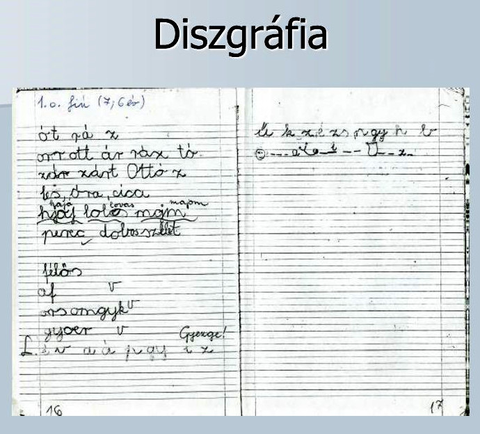 7. ábra - Diszgráfiás gyermek füzete, írásképe 7. ábra - Diszgráfiás gyermek füzete, írásképe